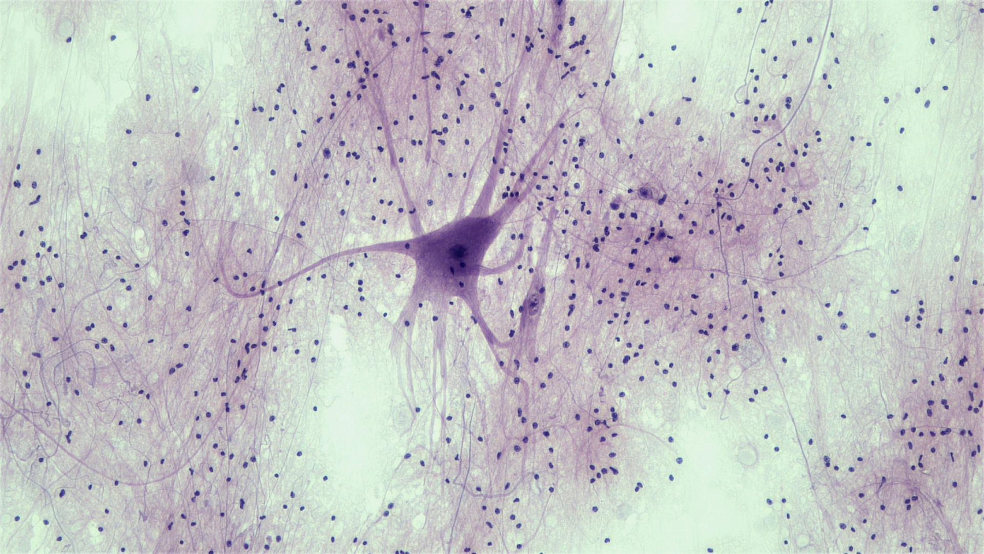 Carousel image